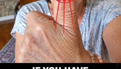 What Do Vertical Lines on Your Nails Reveal About Your Daily Habits and Wellness as You Age?