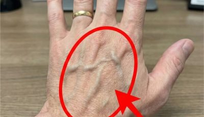 If you have visible veins, it means you are…see more