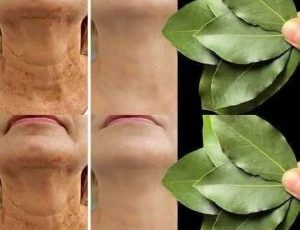 Bay Leaf The Natural Wrinkle Eraser for Ageless Beauty