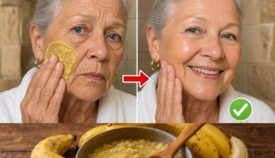You’ll never need makeup again! My grandmother mixed two ingredients and her skin is as clear as glass, without a single wrinkle… To continue