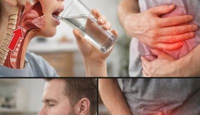 10 symptoms of hiatal hernia you should know!