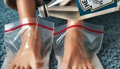 I Tried Vinegar on My Feet: What You Should Know