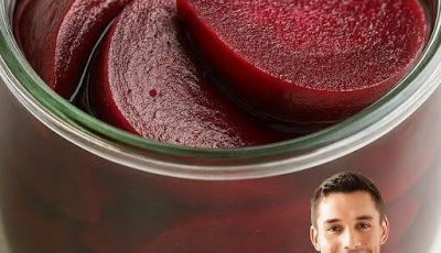 The Beetroot Upgrade: What Happens to Your Body When You Eat Beets, According to Doctors