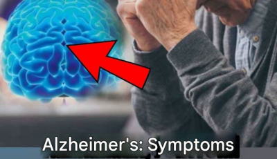 Alzheimer’s Disease: Possible Cause Discovered: Experts Announce(1 / 2)