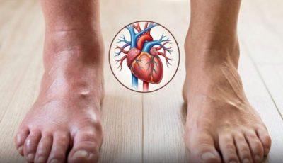 One Month Before a Heart Attack: 7 Warning Signs Your Body May Show
