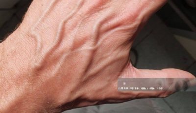 If you have visible veins, it means you are…