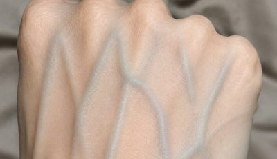 If your veins are visible, here’s what it means