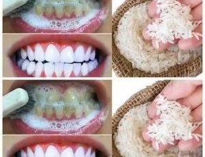 “I tried this 1-minute trick with ingredients from my kitchen… Result: My teeth got whiter instantly.”