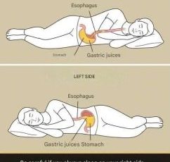 Remember that if you always sleep on your right side, you… Read more