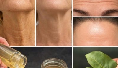 Why bay leaf is a natural solution for wrinkles – 100,000 times more effective than Botox!