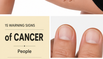 15 early warning signs of cancer that are ignored until it’s too late.