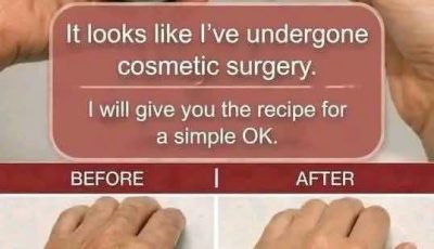 Homemade Hand Remedy for Wrinkles and Age Spots