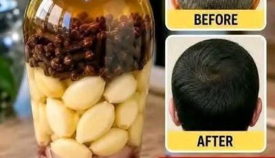 Onion Hair Oil