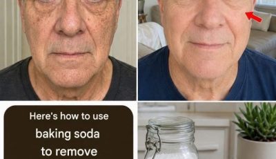 Baking Soda on the Face