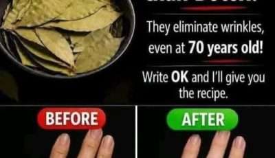 Bay Leaf Skin Recipe