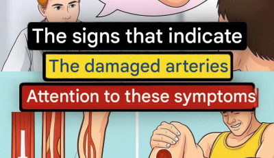 Clogged Arteries: 12 Foods That Harm Your Heart and Circulation(1 / 4)