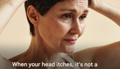 Itchy scalp: what are the possible causes? Answers from a dermatologist