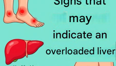Is your liver giving you warning signs? 11 signs that betray a toxic overload