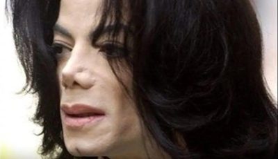 Michael Jackson: What is vitiligo, the disease that affected the King of Pop?