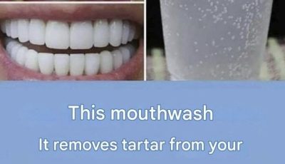 A natural method for removing tartar