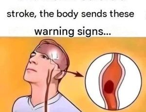 One month before a stroke, your body sends you these warning signals.