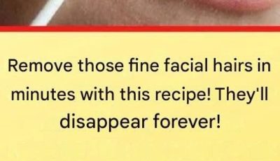 This natural recipe will permanently remove facial hair