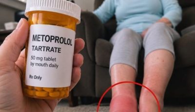 Metoprolol: The Good, The Bad, and The UGLY – Your No-BS Guide to 10 Common Side Effects
