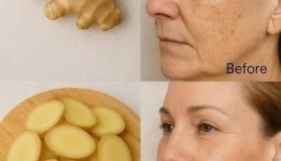 Ginger is 100 times more powerful than Botox in removing deep wrinkles, freckles and dark spots Must express something to keep getting my recipes…. Thank you Recipe in (c.o.m.m.e.n.t ).