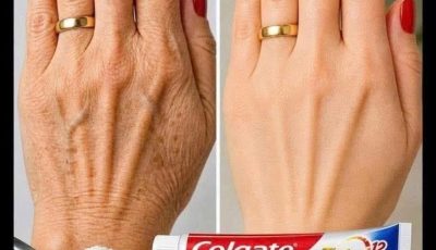 Look at this… these hands looked aged, full of spots
