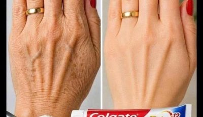 Look at this… these hands looked aged, full of spots