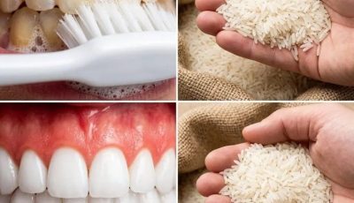 A radiant smile in sixty seconds: the little-known rice-based method