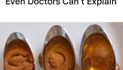 Cinnamon and Honey: A Powerful Remedy Even Doctors Can’t Fully Explain