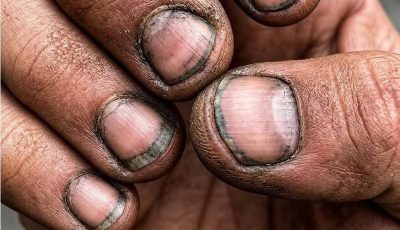Dirty nails don’t always indicate a lack of hygiene, but rather hard work.
